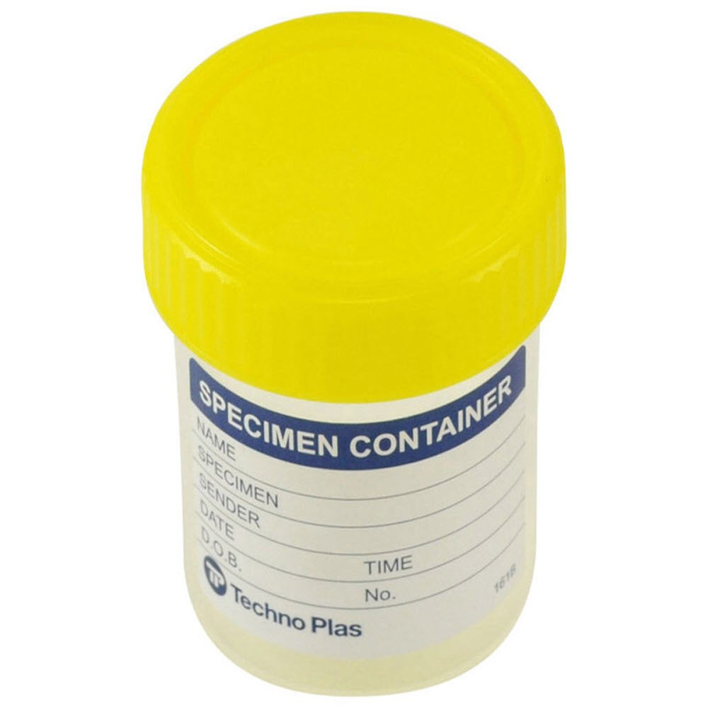 Specimen Jars [70ml] Alpha Sport