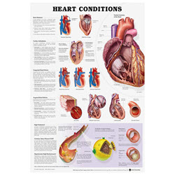ZZZZ HEART CONDITIONS POSTER 51 x 66CM LAMINATED **DISCONTINUED**