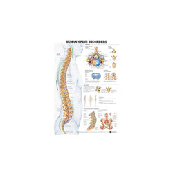 The Human Spine Disorders Chart Laminated