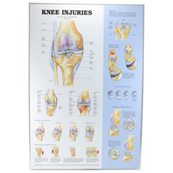 Knee Injuries Chart Laminated